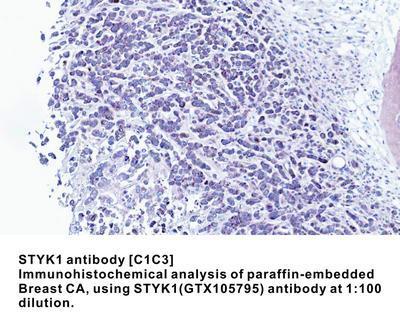 STYK1 antibody [C1C3], GeneTex