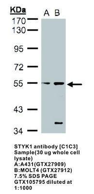 STYK1 antibody [C1C3], GeneTex