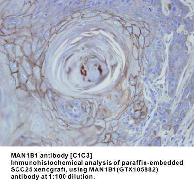 MAN1B1 antibody [C1C3], GeneTex