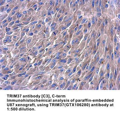 TRIM37 antibody [C3], C-term, GeneTex