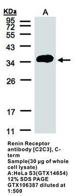 Renin Receptor  antibody [C2C3], C-term, GeneTex