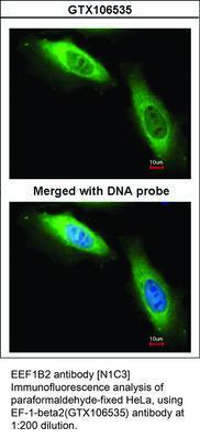 EEF1B2 antibody [N1C3], GeneTex