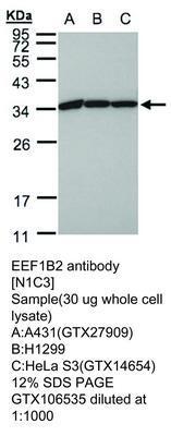 EEF1B2 antibody [N1C3], GeneTex