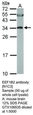 EEF1B2 antibody [N1C3], GeneTex