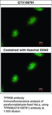 TPRKB antibody, GeneTex