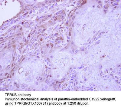 TPRKB antibody, GeneTex