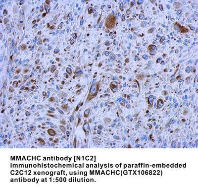 MMACHC antibody [N1C2], GeneTex