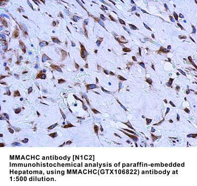 MMACHC antibody [N1C2], GeneTex