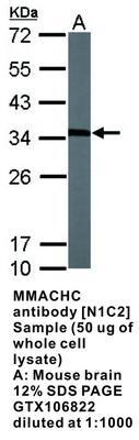 MMACHC antibody [N1C2], GeneTex