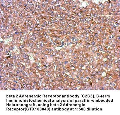 beta 2 Adrenergic Receptor antibody [C2C3], C-term, GeneTex