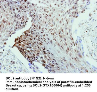 BCL2 antibody [N1N2], N-term, GeneTex