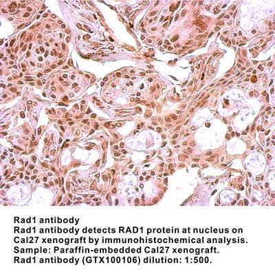 RAD1 antibody [N2C3], GeneTex