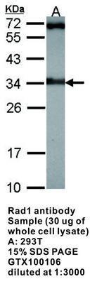 RAD1 antibody [N2C3], GeneTex