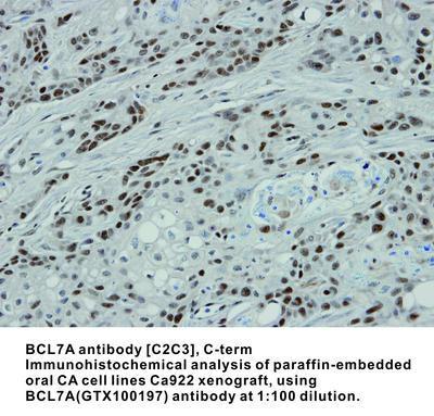 BCL7A antibody [C2C3], C-term, GeneTex