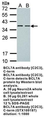 BCL7A antibody [C2C3], C-term, GeneTex