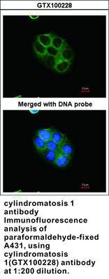 cylindromatosis 1 antibody, GeneTex