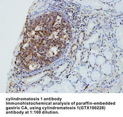 cylindromatosis 1 antibody, GeneTex