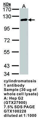 cylindromatosis 1 antibody, GeneTex