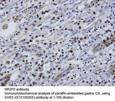 NR2F6 antibody, GeneTex