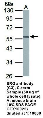 ERG antibody [C3], C-term, GeneTex