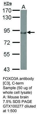 FOXO3A antibody [C3], C-term, GeneTex