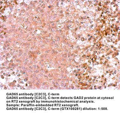 GAD65 antibody [C2C3], C-term, GeneTex