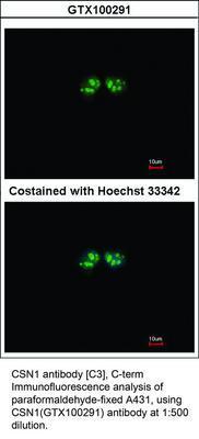 CSN1 antibody [C3], C-term, GeneTex