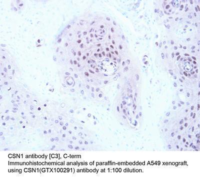 CSN1 antibody [C3], C-term, GeneTex