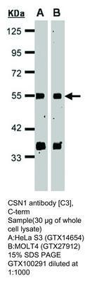 CSN1 antibody [C3], C-term, GeneTex