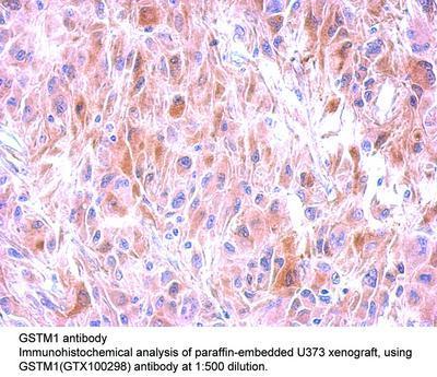 GSTM1 antibody - Rabbit Polyclonal - IHC-P, WB - 100µl, GeneTex