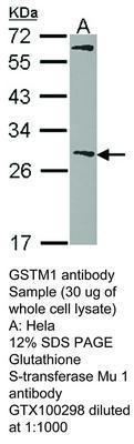 GSTM1 antibody - Rabbit Polyclonal - IHC-P, WB - 100µl, GeneTex