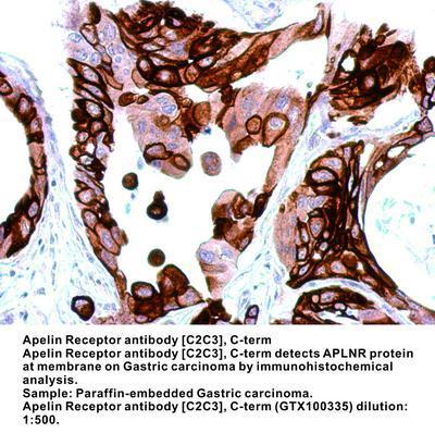 Apelin Receptor antibody [C2C3], C-term, GeneTex