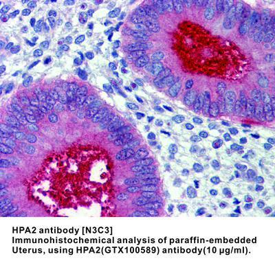 HPA2 antibody [N3C3], GeneTex