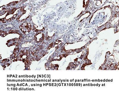 HPA2 antibody [N3C3], GeneTex