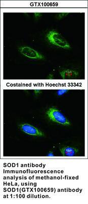 SOD1 antibody, GeneTex