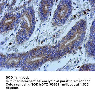 SOD1 antibody, GeneTex