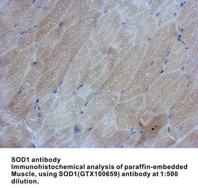 SOD1 antibody, GeneTex