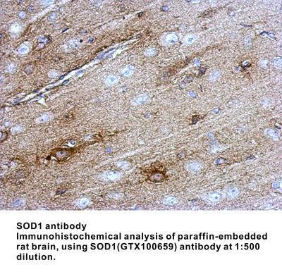 SOD1 antibody, GeneTex