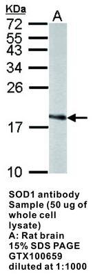 SOD1 antibody, GeneTex