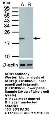 SOD1 antibody, GeneTex