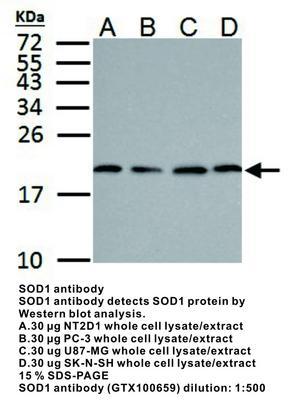 SOD1 antibody, GeneTex