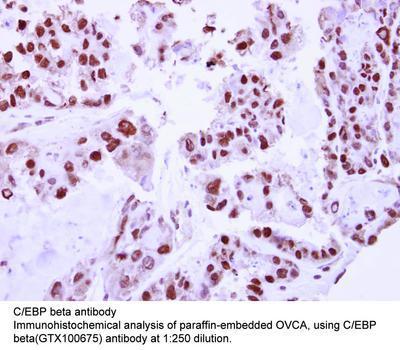 C/EBP beta antibody, GeneTex