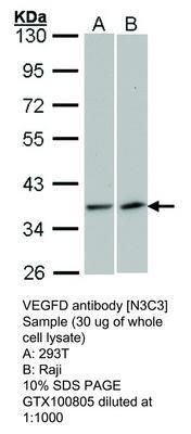 VEGFD antibody [N3C3], GeneTex