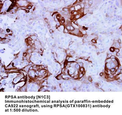 RPSA antibody [N1C3], GeneTex