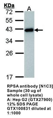 RPSA antibody [N1C3], GeneTex