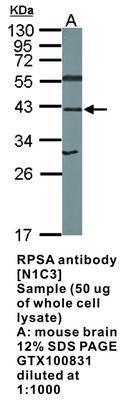 RPSA antibody [N1C3], GeneTex