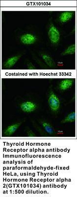 Thyroid Hormone Receptor alpha antibody, GeneTex