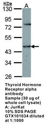 Thyroid Hormone Receptor alpha antibody, GeneTex