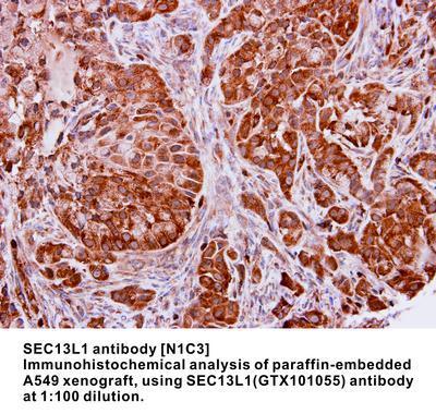 SEC13L1 antibody [N1C3], GeneTex