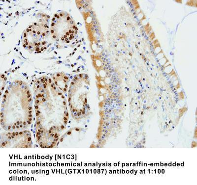 VHL antibody [N1C3], GeneTex